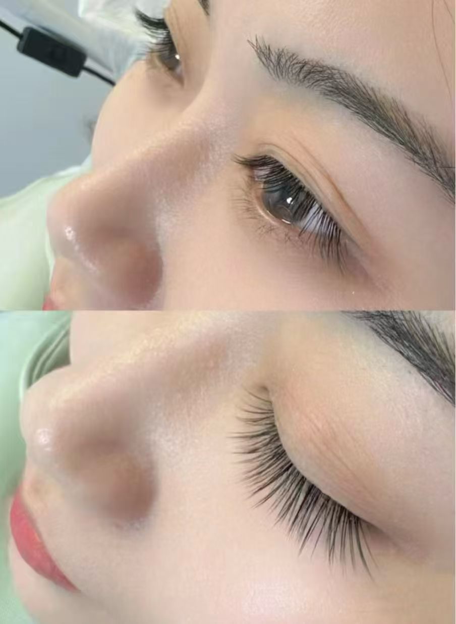 Skin Renewal